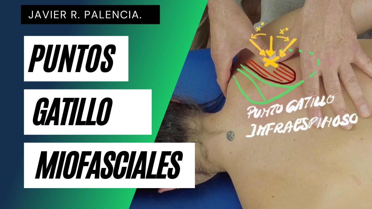 CURSO INTRODUCCIÓN A LOS PUNTOS GATILLO MIOFASCIALES (PGM)