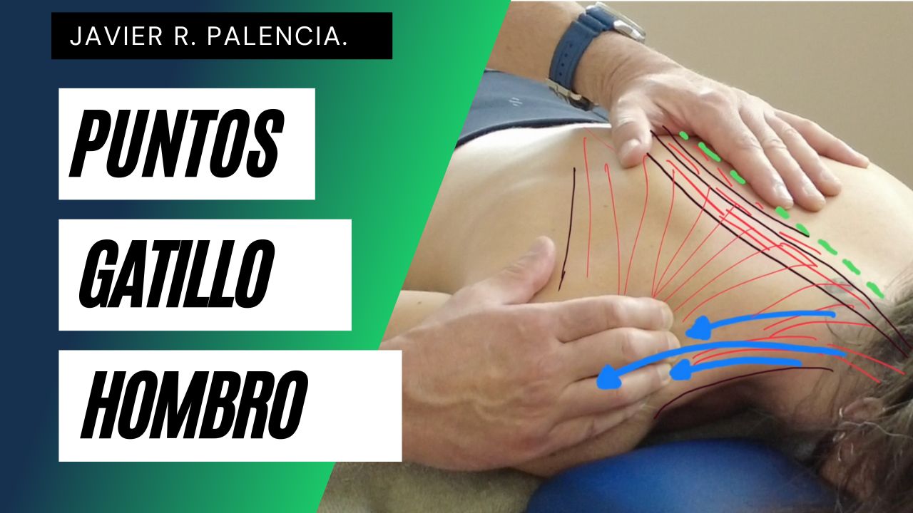 PUNTOS GATILLO DEL HOMBRO