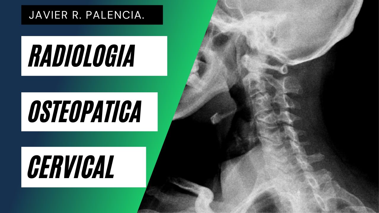Curso de RADIOLOGIA OSTEOPÁTICA CERVICAL